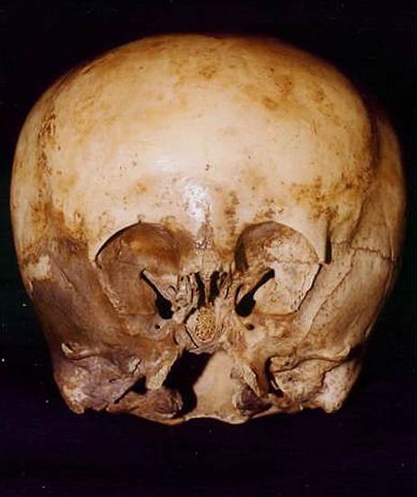 starchild skull